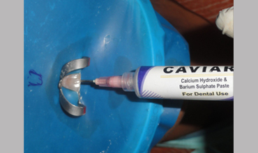 Dental care in Anand                        